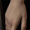 身体そばかす